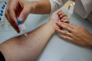 Teste Alergia